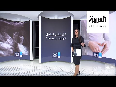 اليمن اليوم- شاهد: دراسة تكشف حقيقة انتقال كورونا من الأم الحامل إلى الجنين1710733/0