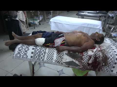 اليمن اليوم- شاهد: استشهاد مواطن وإصابة أخر بقصف مدفعي للمليشيات الحوثية1710939/0