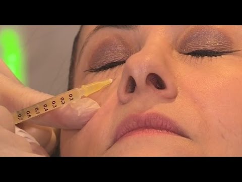 فيديو تقنية مصاصي الدماء لتجديد بشرة الوجه