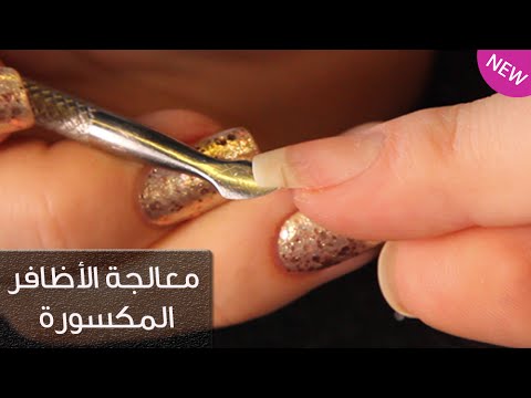 بالفيديو كيفية معالجة اظافر اليد المكسورة
