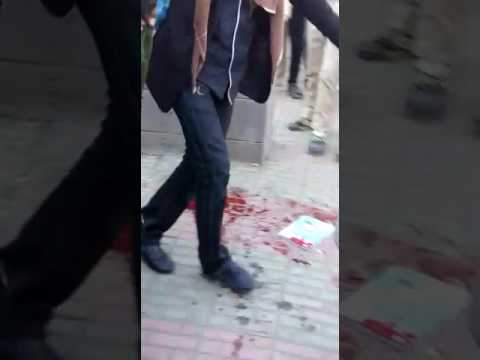 مقتل طالبين في مدرسة باليمن بعد لهو زميلهما بقنبلة