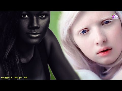 شاهد فتيات يمتلكن أغرب لون بشرة في العالم